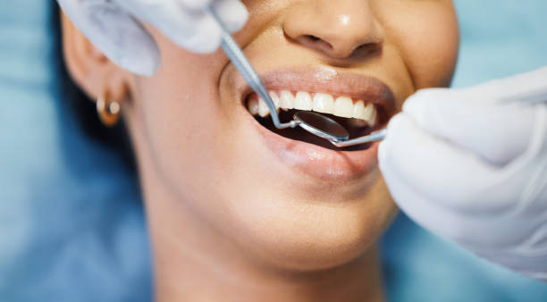 Best Emergency Care for Gum Disease in Gold River, CA