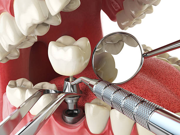 Best 24-Hour Emergency Dental Care in Gold River, CA