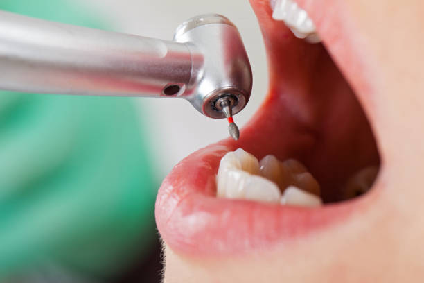 Best Emergency Orthodontic Repairs in Gold River, CA
